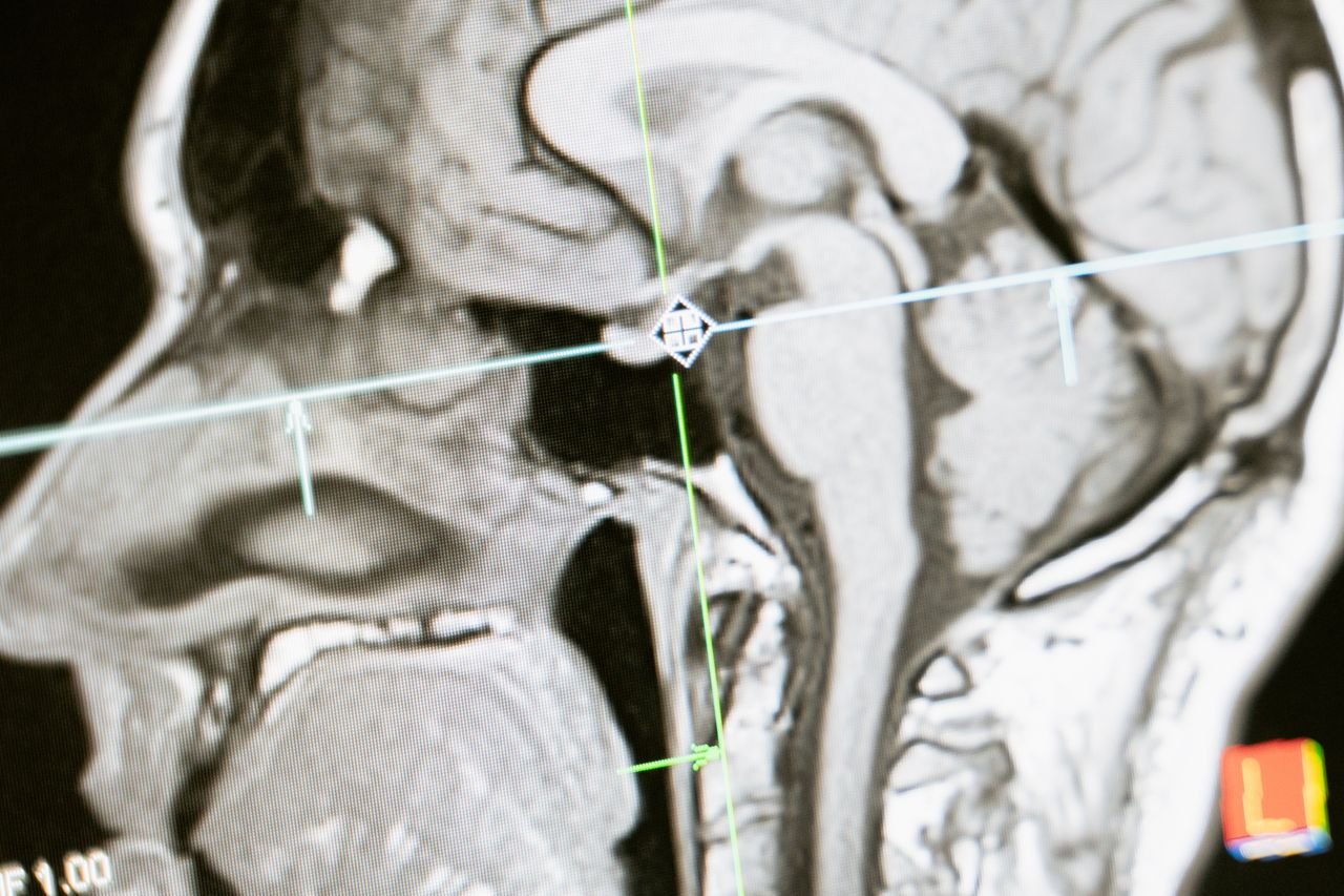 Services Close-up of an MRI scan showing a sagittal view of the human brain for analysis.